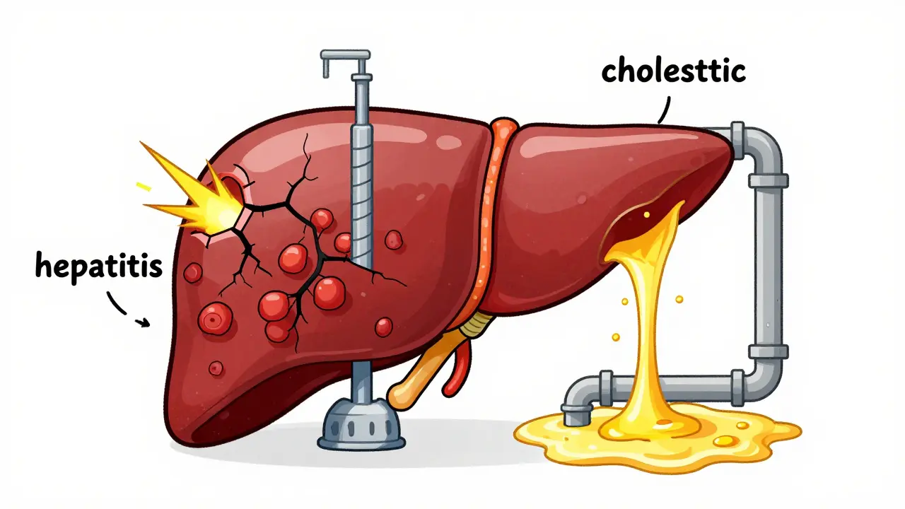 Antibiotic-Related Liver Injury: Understanding Hepatitis and Cholestasis